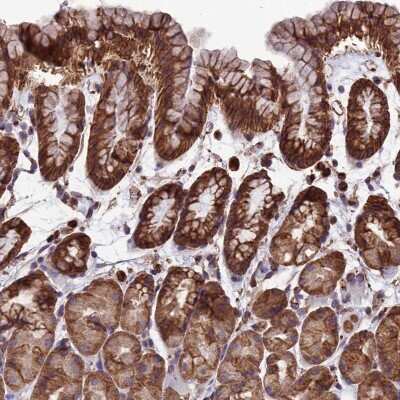 Immunohistochemistry-Paraffin LSM6 Antibody