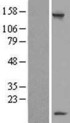 Western Blot: LSM7 Overexpression Lysate (Adult Normal) [NBL1-12730] Left-Empty vector transfected control cell lysate (HEK293 cell lysate); Right -Over-expression Lysate for LSM7.