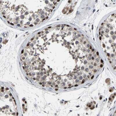 Immunohistochemistry-Paraffin LSM8 Antibody