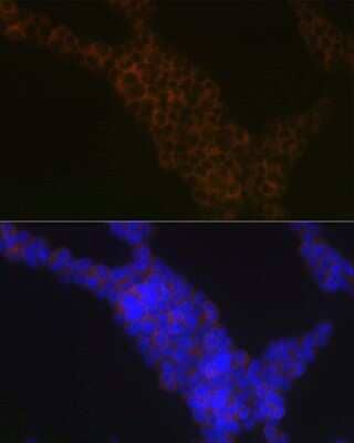 Immunocytochemistry/Immunofluorescence: LSP1 Antibody (4U10N5) [NBP3-16171] - Immunofluorescence analysis of Jurkat cells using LSP1 Rabbit mAb (NBP3-16171) at dilution of 1:100 (40x lens). Blue: DAPI for nuclear staining.