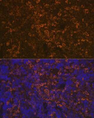 Immunohistochemistry: LSP1 Antibody (4U10N5) [NBP3-16171] - Immunofluorescence analysis of rat spleen using LSP1 Rabbit mAb (NBP3-16171) at dilution of 1:100 (40x lens). Blue: DAPI for nuclear staining.