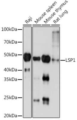 Western Blot: LSP1 Antibody (4U10N5) [NBP3-16171] - Western blot analysis of extracts of various cell lines, using LSP1 Rabbit mAb (NBP3-16171) at 1:1000 dilution. Secondary antibody: HRP Goat Anti-Rabbit IgG (H+L) at 1:10000 dilution. Lysates/proteins: 25ug per lane. Blocking buffer: 3% nonfat dry milk in TBST. Detection: ECL Basic Kit. Exposure time: 3min.