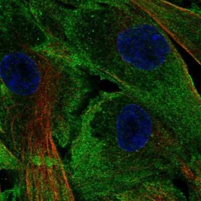 Immunocytochemistry/Immunofluorescence: LSP1 Antibody [NBP2-57862] - Staining of human cell line ASC TERT1 shows localization to plasma membrane. Antibody staining is shown in green.