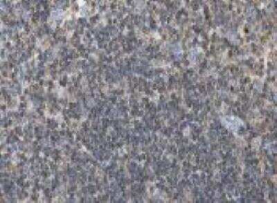 Immunohistochemistry: LSP1 Antibody [24780002] - Staining for lymphocyte-specific protein 1 (LSP1) in human lymphoidal  tissues.  Lymphoid tissues of lymph nodes displayed moderate to strong cytoplasmic positivity.  Normal epithelial and stromal cells were negative.  Most malignant lymphomas and a few cases of urothelial cancers expressed moderate cytoplasmic immunoreactivity (images not shown).  These image are the courtesy of the Human Proteome Resource (HPR).