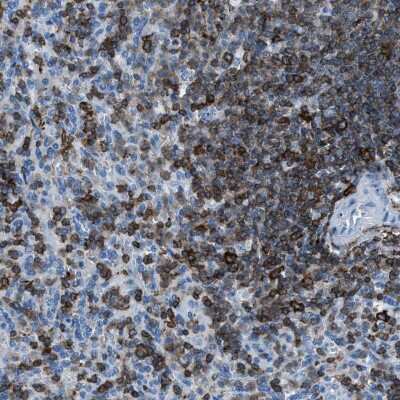 Immunohistochemistry-Paraffin: LSP1 Antibody [NBP1-86852] - Staining of human spleen shows high expression.