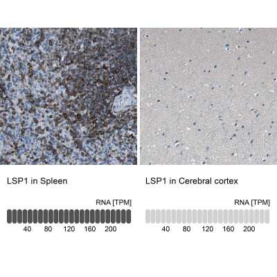 <b>Orthogonal Strategies Validation. </b>Immunohistochemistry-Paraffin: LSP1 Antibody [NBP1-86852] - Staining in human spleen and cerebral cortex tissues using anti-LSP1 antibody. Corresponding LSP1 RNA-seq data are presented for the same tissues.