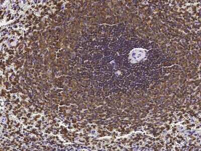 Immunohistochemistry-Paraffin: LSP1 Antibody [NBP3-00254] - Staining of human LSP1 in human spleen with rabbit polyclonal antibody (1:2000).