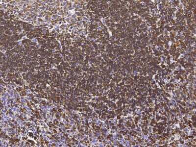 Immunohistochemistry-Paraffin: LSP1 Antibody [NBP3-00254] - Staining of human LSP1 in human tonsil with rabbit polyclonal antibody (1:2000).