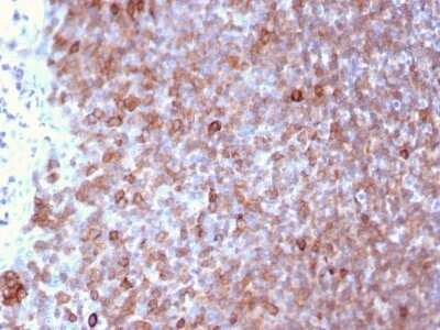 Immunohistochemistry-Paraffin: LSP1 Antibody (LSP1/3025) - Azide and BSA Free [NBP2-79859] - Formalin-fixed, paraffin-embedded human Lymph Node stained with LSP1 Antibody (LSP1/3025).