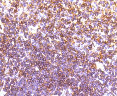 Immunohistochemistry-Paraffin: LSP1 Antibody (SN06-25) [NBP2-67725] - Analysis of paraffin-embedded human tonsil tissue using anti-LSP1 antibody. Counter stained with hematoxylin.