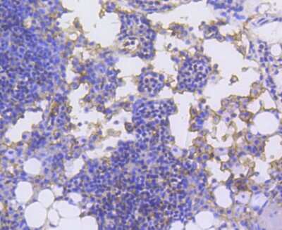 Immunohistochemistry-Paraffin: LSP1 Antibody (SN06-25) [NBP2-67725] - Analysis of paraffin-embedded mouse thymus tissue using anti-LSP1 antibody. Counter stained with hematoxylin.