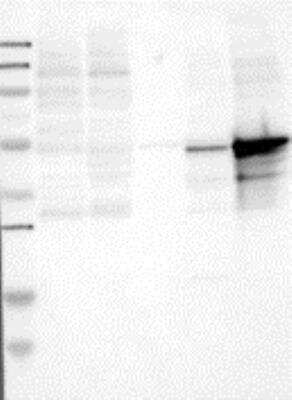 Western Blot: LSP1 Antibody [24780002] - Samples: Lane 1, Marker [kDa]: 250, 130, 95, 72, 55, 36, 28, 17, 11  Lane 2, RT-4 Lane 3, U-251MG sp  Lane 4, Human Plasma  Lane 5, Liver  Lane 6, Tonsil, Target weight [kDa]: 50, 38, 37, 30 (splice variants) Validation score: 2   Validation description: Supportive - Band of predicted size in kDa (+/-20%) with additional bands present.