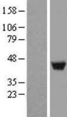 Western Blot: LSP1 Overexpression Lysate (Adult Normal) [NBL1-12732] Left-Empty vector transfected control cell lysate (HEK293 cell lysate); Right -Over-expression Lysate for LSP1.