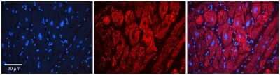 Immunohistochemistry: LSS Antibody [NBP1-53166] - Formalin Fixed Paraffin Embedded Tissue: Human heart Tissue Observed Staining: Cytoplasmic Primary Antibody Concentration: N/A Other Working Concentrations: 1:600 Secondary Antibody: Donkey anti-Rabbit-Cy3 Secondary Antibody Concentration: 1:200 Magnification: 20X Exposure Time: 0.5 - 2.0 sec