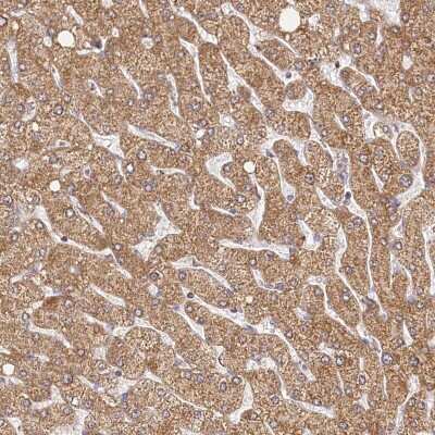 Immunohistochemistry-Paraffin: LSS Antibody [NBP2-33966] - Staining of human liver shows moderate cytoplasmic positivity in hepatocytes.