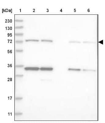 Western Blot: LSS Antibody [NBP2-33966] - Lane 1: Marker [kDa] 230, 130, 95, 72, 56, 36, 28, 17, 11Lane 2: Human cell line RT-4Lane 3: Human cell line U-251 MGLane 4: Human plasmaLane 5: Human Liver tissueLane 6: Human Tonsil tissue