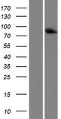 Western Blot: LSS Overexpression Lysate (Adult Normal) [NBP2-08981] Left-Empty vector transfected control cell lysate (HEK293 cell lysate); Right -Over-expression Lysate for LSS.