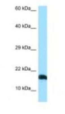 Western Blot: LST1 Antibody [NBP1-98482] - 293T Cell Lysate 1.0ug/ml, Gel Concentration: 10-20%