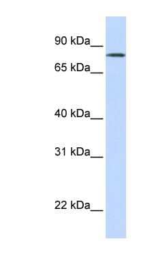 Western Blot: LST3 Antibody [NBP1-59440] - Human Lung lysate, concentration 0.2-1 ug/ml.