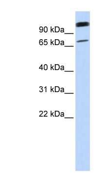 Western Blot: LST3 Antibody [NBP1-59483] - 721_B cell lysate, concentration 0.2-1 ug/ml.