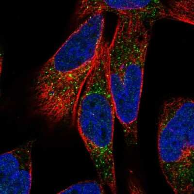 Immunocytochemistry/Immunofluorescence: LTK Antibody [NBP2-32475] - Staining of human cell line RH-30 shows localization to vesicles. Antibody staining is shown in green.