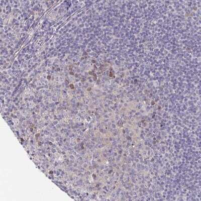 Immunohistochemistry-Paraffin: LTK Antibody [NBP2-32475] - Staining of human tonsil shows moderate cytoplasmic positivity in subset of germinal center cells.