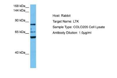 Western Blot: LTK Antibody [NBP2-87756] - Host: Rabbit. Target Name: LTK. Sample Tissue: Human COLO205 Whole Cell lysates. Antibody Dilution: 1ug/ml