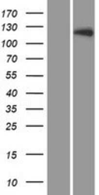 Western Blot: LTK Overexpression Lysate (Adult Normal) [NBP2-08125] Left-Empty vector transfected control cell lysate (HEK293 cell lysate); Right -Over-expression Lysate for LTK.