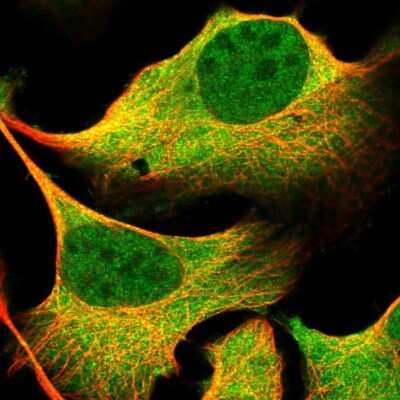 Immunocytochemistry/Immunofluorescence: LTV1 Antibody [NBP1-86733] - Immunofluorescent staining of human cell line U-2 OS shows localization to nucleoplasm & cytosol.