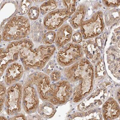 Immunohistochemistry-Paraffin: LTV1 Antibody [NBP1-86733] - Staining of human kidney shows moderate cytoplasmic and membranous positivity in cells in tubules.