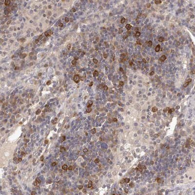 Immunohistochemistry-Paraffin: LTV1 Antibody [NBP1-86734] - Staining of human lymph node shows strong positivity in subsets of cells outside the germinal center.