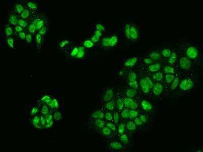 Immunocytochemistry/Immunofluorescence: LUC7L2 Antibody [NBP3-06338] - Immunofluorescence staining of LUC7L2 in MCF7 cells. Cells were fixed with 4% PFA, permeabilzed with 0.3% Triton X-100 in PBS,blocked with 10% serum, and incubated with rabbit anti-Human LUC7L2 polyclonal antibody (dilution ratio 1:200) at 4 degrees celsius overnight. Then cells were stained with the Alexa Fluor (TM) 488-conjugated Goat Anti-rabbit IgG secondary antibody (green). Positive staining was localized to Nucleus.