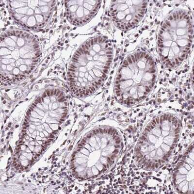 Immunohistochemistry-Paraffin LUC7L2 Antibody