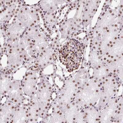 Immunohistochemistry-Paraffin LUC7L2 Antibody