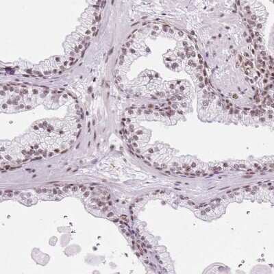 Immunohistochemistry-Paraffin LUC7L2 Antibody