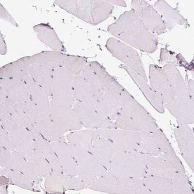 Immunohistochemistry-Paraffin: LUC7L2 Antibody [NBP2-33621] - Staining of human skeletal muscle shows no positivity in myocytes as expected .