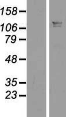 Western Blot: LUZP1 Overexpression Lysate (Adult Normal) [NBP2-09657] Left-Empty vector transfected control cell lysate (HEK293 cell lysate); Right -Over-expression Lysate for LUZP1.
