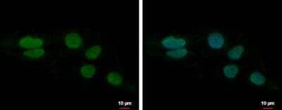 Immunocytochemistry/Immunofluorescence: LUZP4 Antibody [NBP2-17185] - NT2D1 cells. Green: LUZP4 protein stained by LUZP4 antibody [N1C3]. Blue: Hoechst 33342 staining.