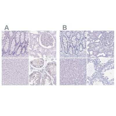 Immunohistochemistry-Paraffin: LUZP4 Antibody [NBP1-94093] - Staining of human colon, kidney, liver and testis using Anti-LUZP4 antibody NBP1-94093 (A) shows similar protein distribution across tissues to independent antibody NBP2-33634 (B).