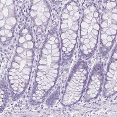 Immunohistochemistry-Paraffin: LUZP4 Antibody [NBP1-94093] - Staining of human colon shows no positivity in glandular cells as expected.