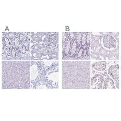<b>Independent Antibodies Validation. </b>Immunohistochemistry-Paraffin: LUZP4 Antibody [NBP2-33634] - Staining of human colon, kidney, liver and testis using Anti-LUZP4 antibody NBP2-33634 (A) shows similar protein distribution across tissues to independent antibody NBP1-94093 (B).