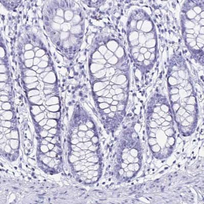 Immunohistochemistry-Paraffin: LUZP4 Antibody [NBP2-33634] - Staining of human colon shows no positivity in glandular cells as expected.