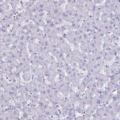 Immunohistochemistry-Paraffin: LUZP4 Antibody [NBP2-33634] - Staining of human liver shows no positivity in hepatocytes as expected.