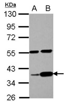 Western Blot: LUZP4 Antibody [NBP2-17185] - Sample (30 ug of whole cell lysate) A: PC-3 B: U87-MG 10% SDS PAGE gel, diluted at 1:1000.