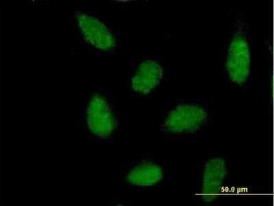 Immunocytochemistry/Immunofluorescence: LXR alpha/NR1H3 Antibody [H00010062-B01P] - Analysis of purified antibody to NR1H3 on HeLa cell. (antibody concentration 10 ug/ml)