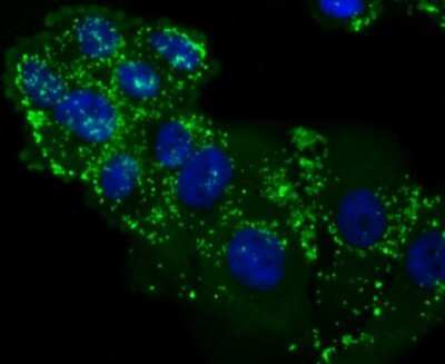 Immunocytochemistry/Immunofluorescence: LXR alpha/NR1H3 Antibody (JA20-38) [NBP2-66938] - Staining LXR alpha/NR1H3 in HepG2 cells (green). The nuclear counter stain is DAPI (blue). Cells were fixed in paraformaldehyde, permeabilised with 0.25% Triton X100/PBS.