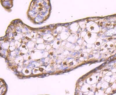 Immunohistochemistry-Paraffin: LXR alpha/NR1H3 Antibody (JA20-38) [NBP2-66938] - Analysis of paraffin-embedded human placenta tissue using anti-LXR alpha/NR1H3 antibody. Counter stained with hematoxylin.