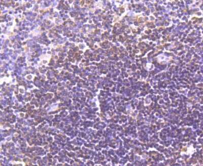 Immunohistochemistry-Paraffin: LXR alpha/NR1H3 Antibody (JA20-38) [NBP2-66938] - Analysis of paraffin-embedded human spleen tissue using anti-LXR alpha/NR1H3 antibody. Counter stained with hematoxylin.