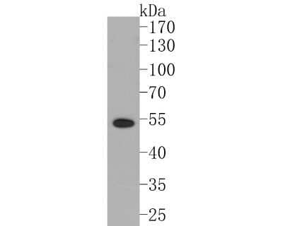 Western Blot: LXR alpha/NR1H3 Antibody (JA20-38) [NBP2-66938] - Analysis of LXR alpha/NR1H3 on human liver tissue lysates. Proteins were transferred to a PVDF membrane and blocked with 5% BSA in PBS for 1 hour at room temperature. The primary antibody (1/500) was used in 5% BSA at room temperature for 2 hours. Goat Anti-Rabbit IgG - HRP Secondary Antibody (HA1001) at 1:5,000 dilution was used for 1 hour at room temperature.