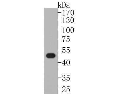 Western Blot: LXR alpha/NR1H3 Antibody (JA20-38) [NBP2-66938] - Analysis of LXR alpha/NR1H3 on mouse colon tissue lysates. Proteins were transferred to a PVDF membrane and blocked with 5% BSA in PBS for 1 hour at room temperature. The primary antibody (1/500) was used in 5% BSA at room temperature for 2 hours. Goat Anti-Rabbit IgG - HRP Secondary Antibody at 1:200,000 dilution was used for 1 hour at room temperature.